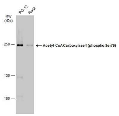 Western Blot: Acetyl-CoA Carboxylase alpha/ACACA [p Ser79] Antibody [NBP3-13324]